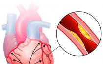 Zemra dhemb, kardiograma është e mirë, ekografia e zemrës është e mirë, por zemra dhemb